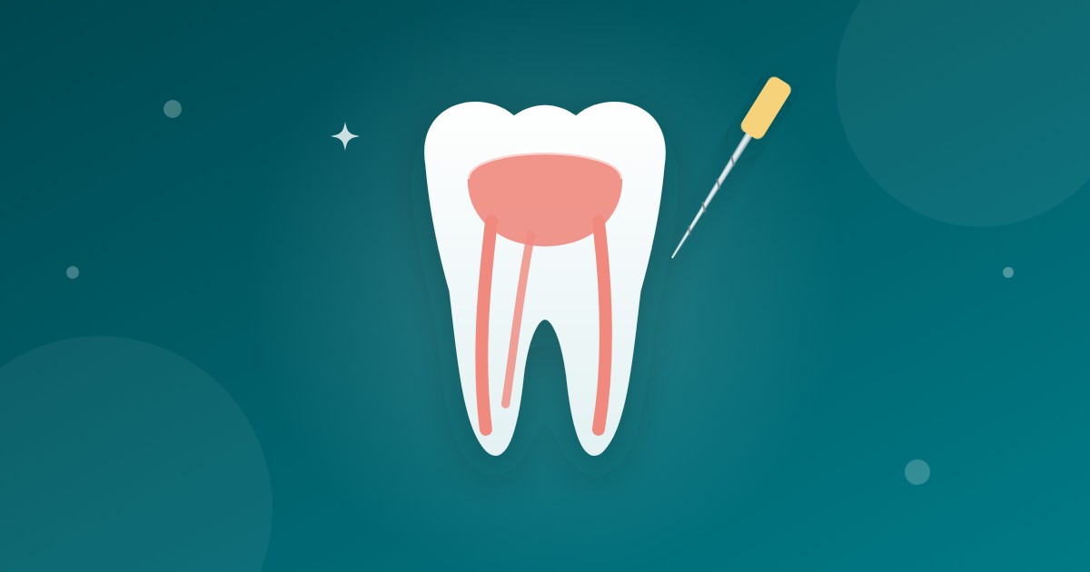 Featured image for “Quanto custa um canal no dente do fundo?”