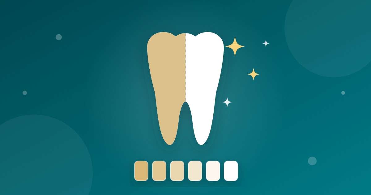 Featured image for “Quanto custa o clareamento dentário? Entenda o que influencia o valor”