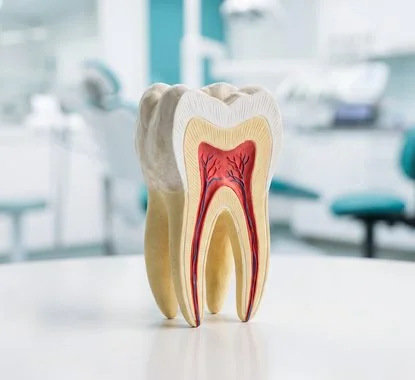 Modelo de dente em corte mostrando polpa e canais – tratamento de canal em Indaiatuba