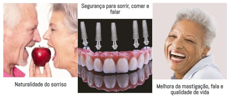 imagem-tratamentos-implantes